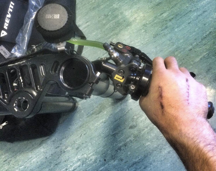 Проверка подвижности кисти Данило Петруччи