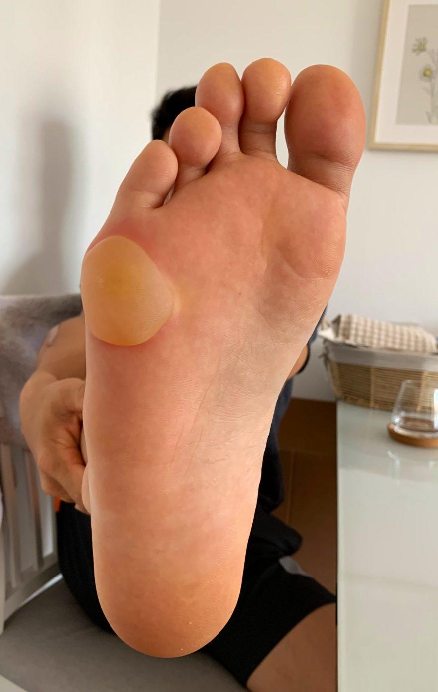 Стопа Накагами